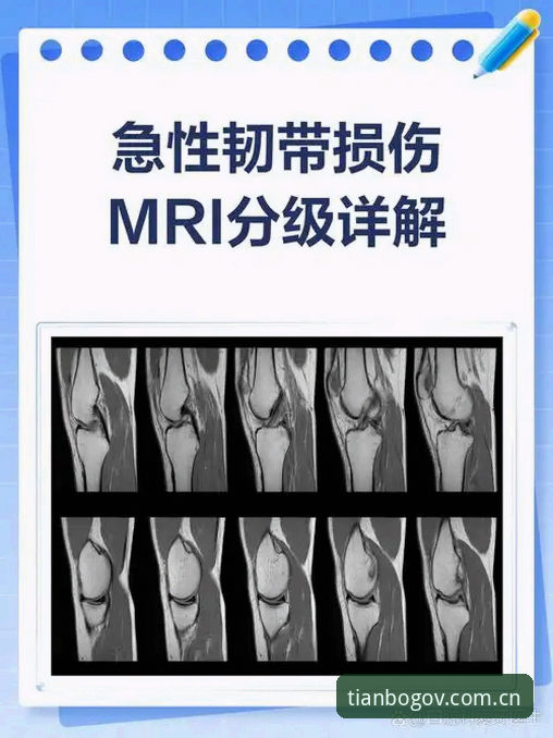 深度揭秘：施洛特贝克韧带撕裂背后，一个其实很简单的选择困境